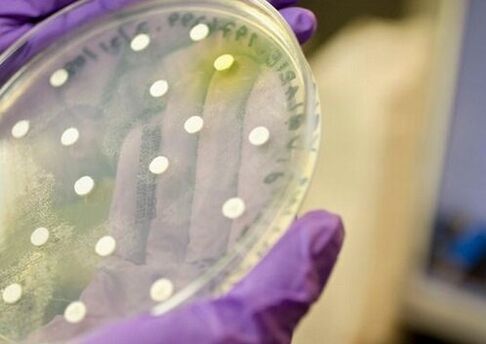 cultivo bacteriano para el diagnóstico de prostatitis